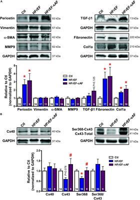 Profibrotic, Electrical, and Calcium-Handling Remodeling of the Atria in Heart Failure Patients With and Without Atrial Fibrillation